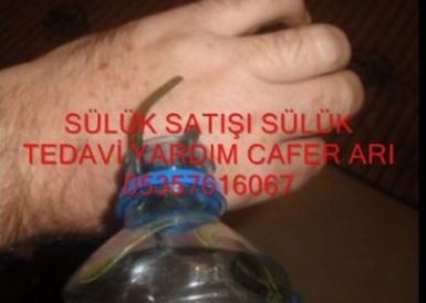  sülük yapıştırma